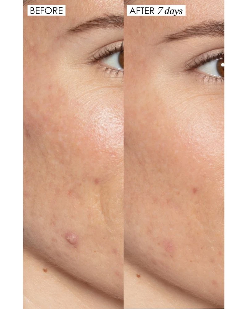 Good Genes Treatment