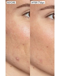 Good Genes Treatment