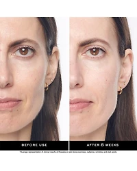 Rénergie H.C.F. Triple Serum