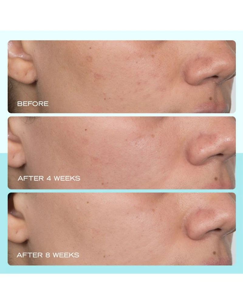 Dark Spot Serum with Niacinamide 1 oz.