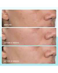 Dark Spot Serum with Niacinamide 1 oz.