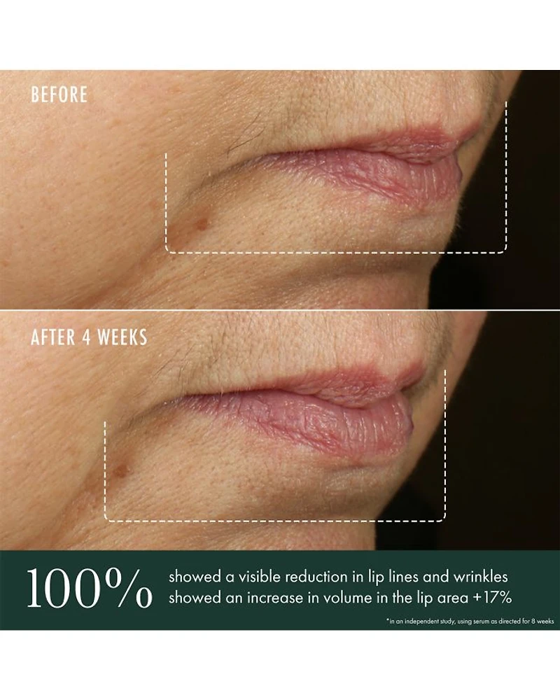 Advanced Lip Perioral Serum Targeted Vertical Line Filler 0.5 oz.