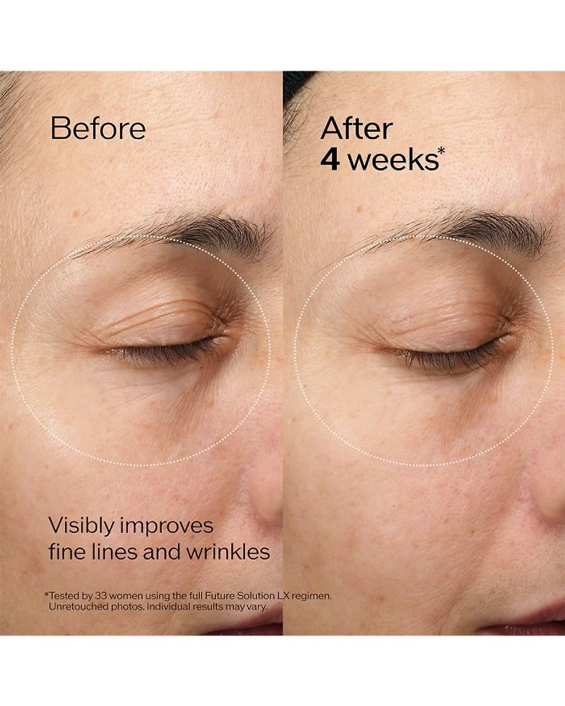 Future Solution LX Eye & Lip Contour Regenerating Cream