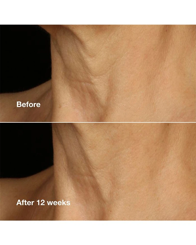 Smart Clinical Repair Lifting Face + Neck Cream