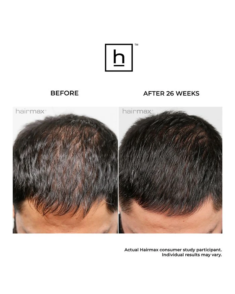 LaserBand 41 ComfortFlex Hair Growth Device