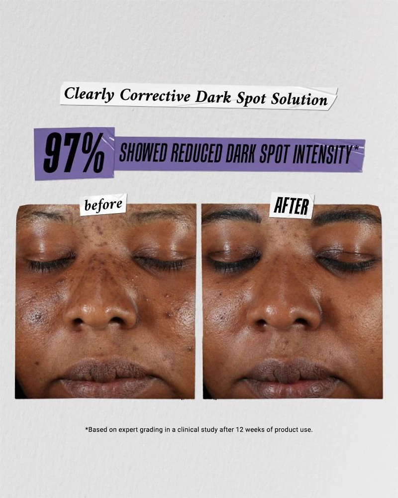 Brighten Up Babes Skincare Set ($104 value)