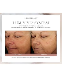 Lumivive System