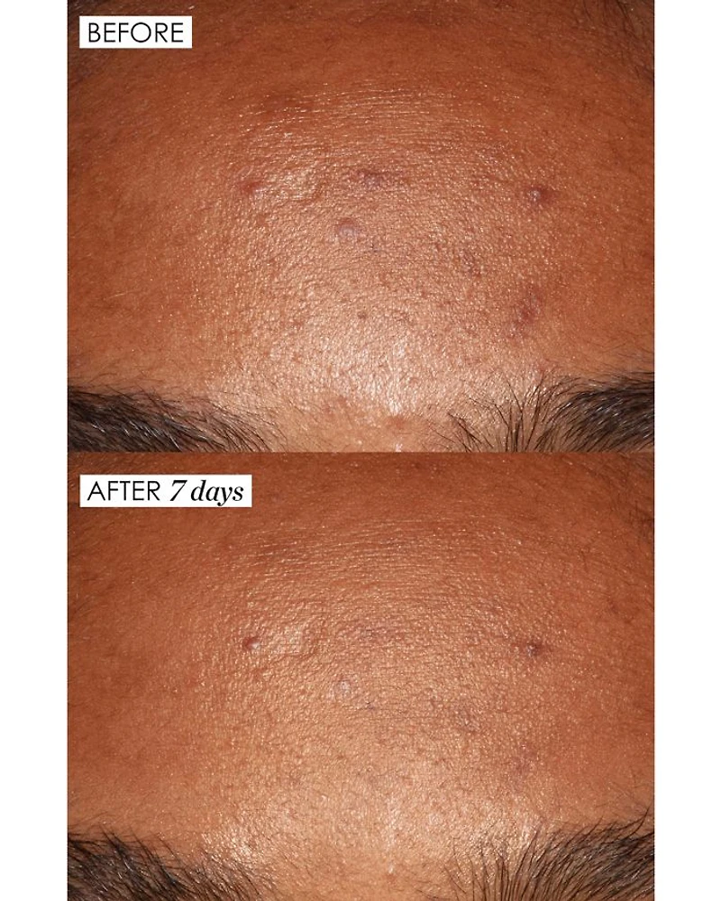 Good Genes Treatment