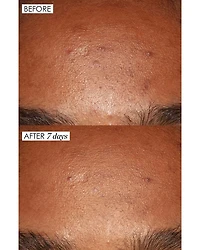Good Genes Treatment