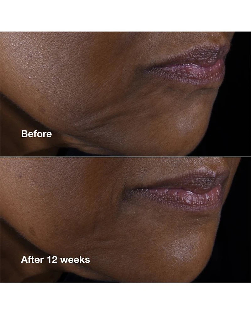 Smart Clinical Repair Lifting Face + Neck Cream