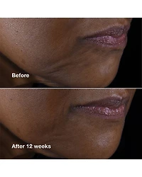 Smart Clinical Repair Lifting Face + Neck Cream