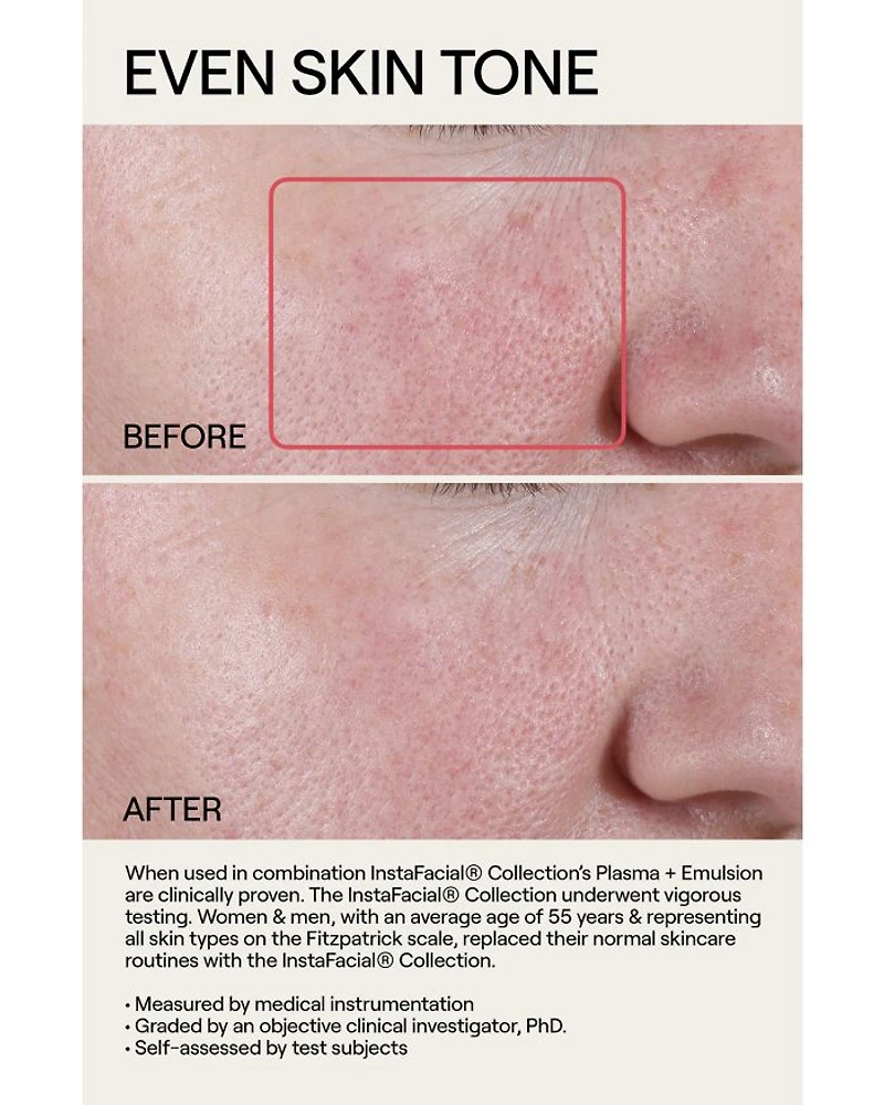 InstaFacial® Plasma Bioactive Growth Factor Serum 1 oz.