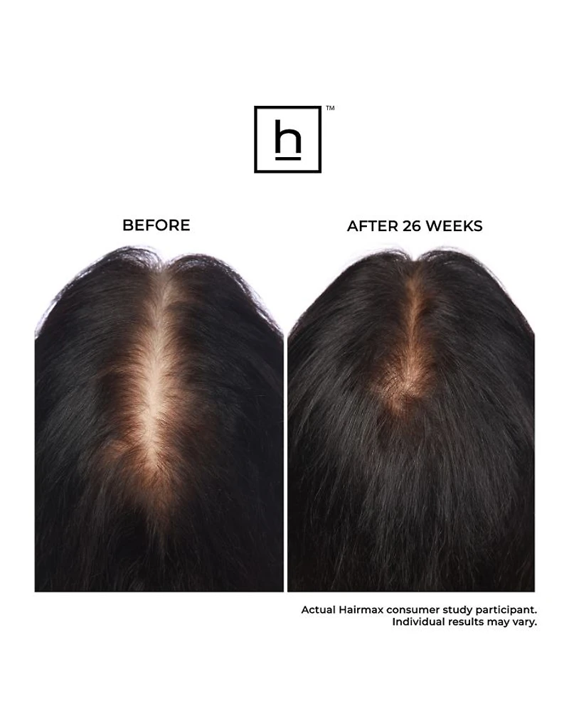 LaserBand 41 ComfortFlex Hair Growth Device
