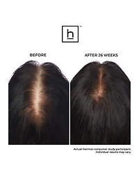 LaserBand 41 ComfortFlex Hair Growth Device