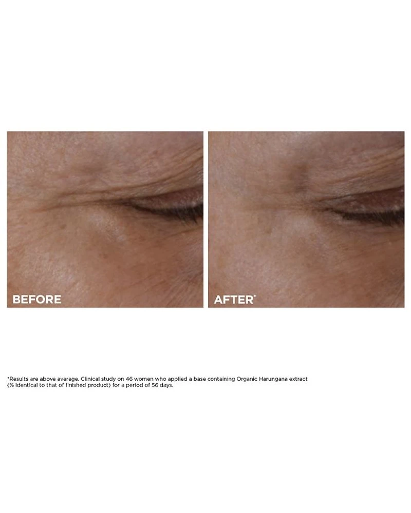 Total Eye Lift Cream
