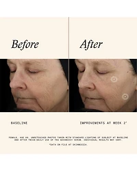 TNS Advanced+ Serum 1 oz.