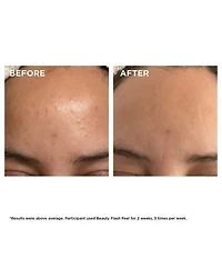 Beauty Flash Peel with BHA & AHA 1.7 oz.