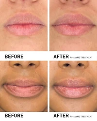 Restorative Lip Treatment 0.4 oz.
