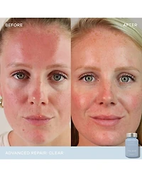 Clear Advanced Repair Dietary Supplement