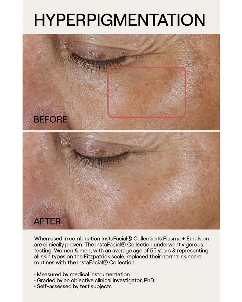 InstaFacial® Plasma Bioactive Growth Factor Serum 1 oz.