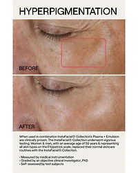 InstaFacial® Plasma Bioactive Growth Factor Serum 1 oz.