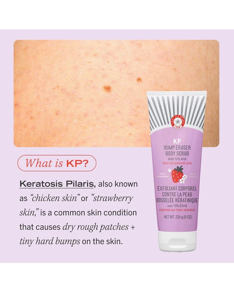 KP Bump Eraser Body Scrub with 10% AHA Exfoliant for Keratosis Pilaris - Strawberry
