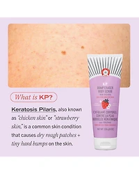 KP Bump Eraser Body Scrub with 10% AHA Exfoliant for Keratosis Pilaris - Strawberry