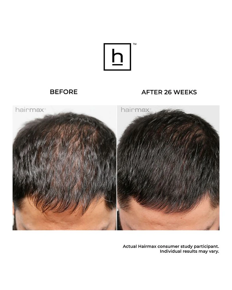Ultima 12 Hair Growth LaserComb