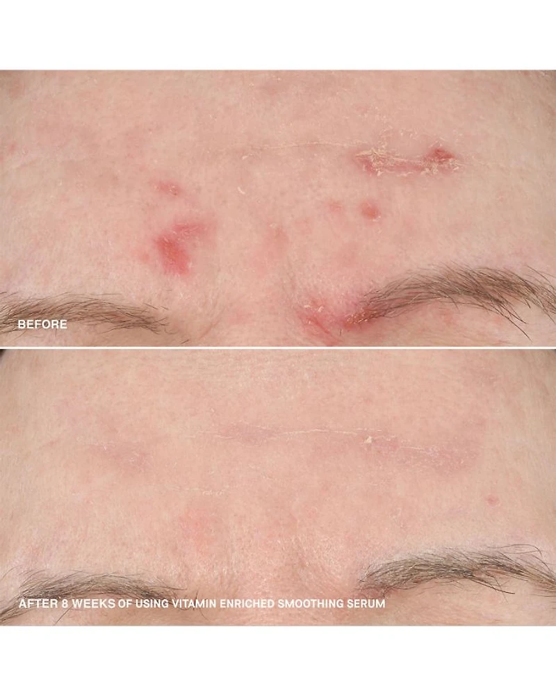 Boost Your Base Vitamin Enriched Moisturizer & Serum Set ($154 value)