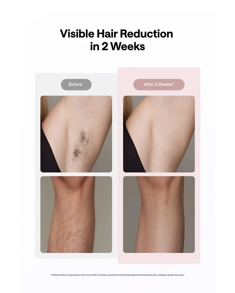 Air 10 Hair Removal Device