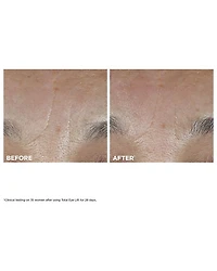 Total Eye Lift Cream