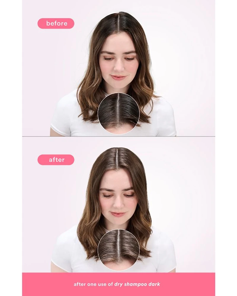 Dry Shampoo Dark 5 oz.
