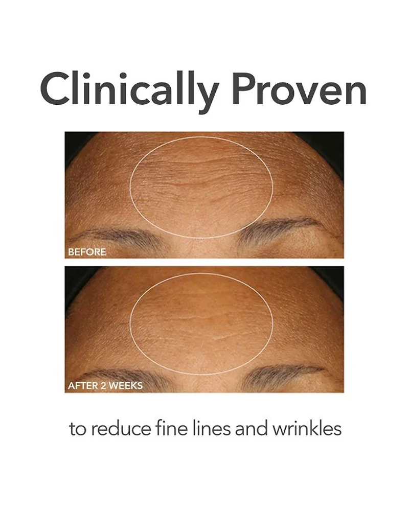 Alpha Beta® Extra Strength Daily Peel