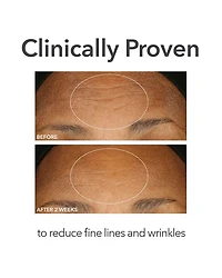 Alpha Beta® Extra Strength Daily Peel