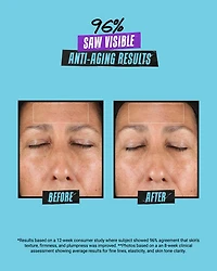 Super Multi Corrective Soft Cream