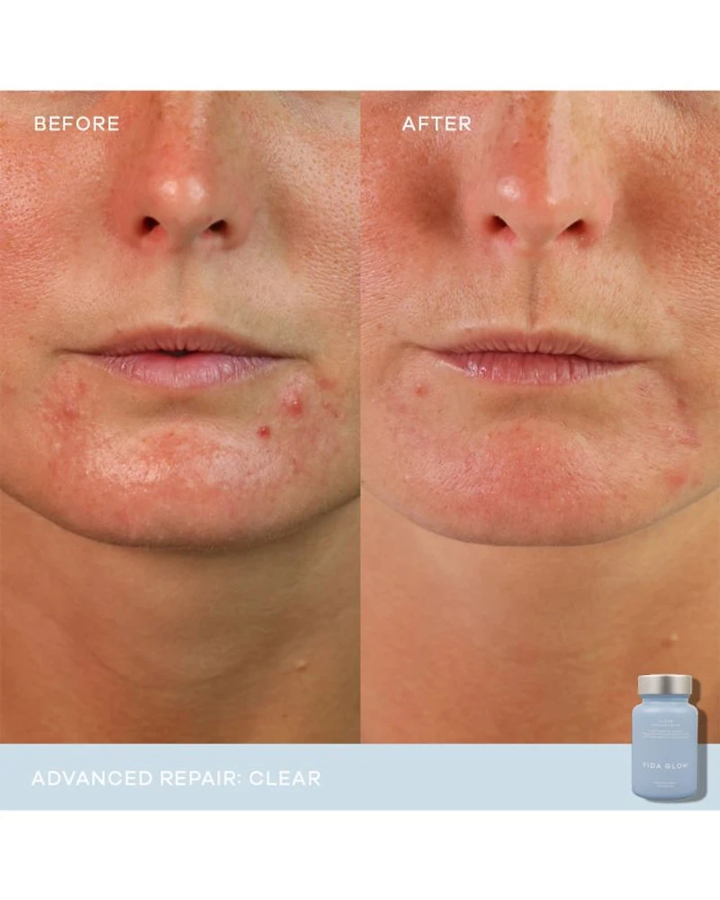 Clear Advanced Repair Dietary Supplement