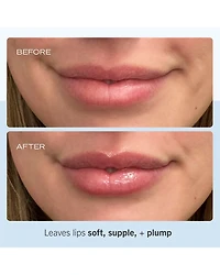 Ultra Repair Lip Balm