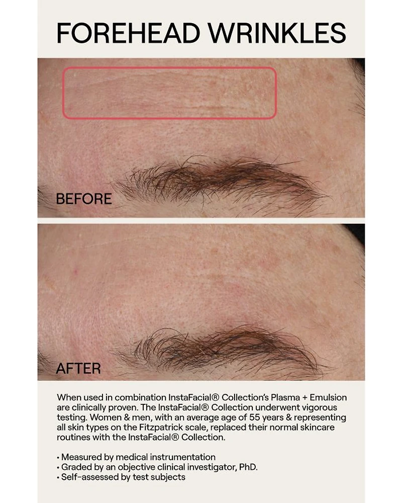 InstaFacial® Plasma Bioactive Growth Factor Serum 1 oz.