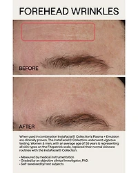 InstaFacial® Plasma Bioactive Growth Factor Serum 1 oz.