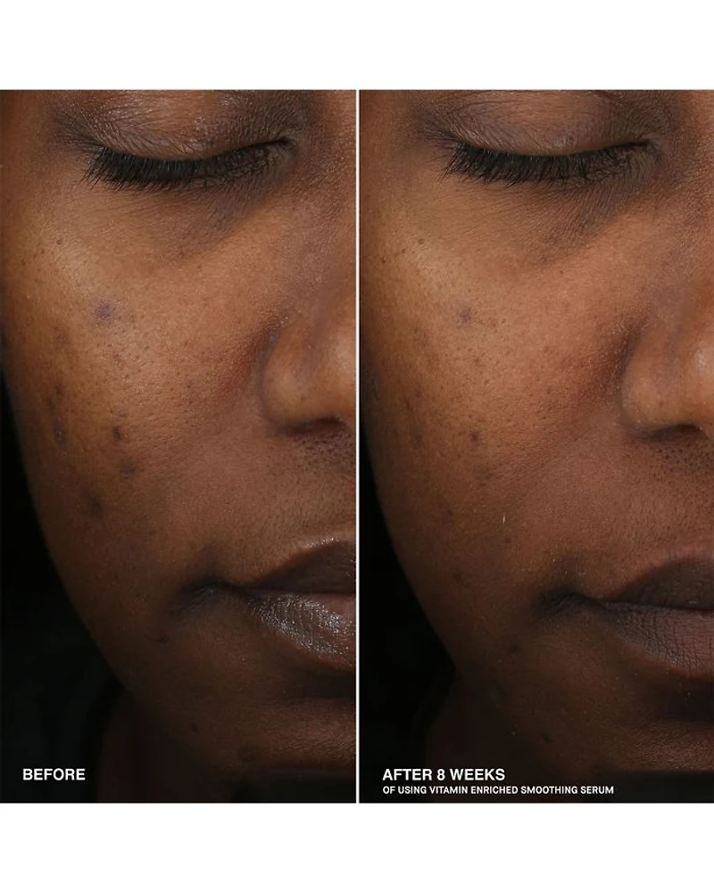 Boost Your Base Vitamin Enriched Moisturizer & Serum Set ($154 value)