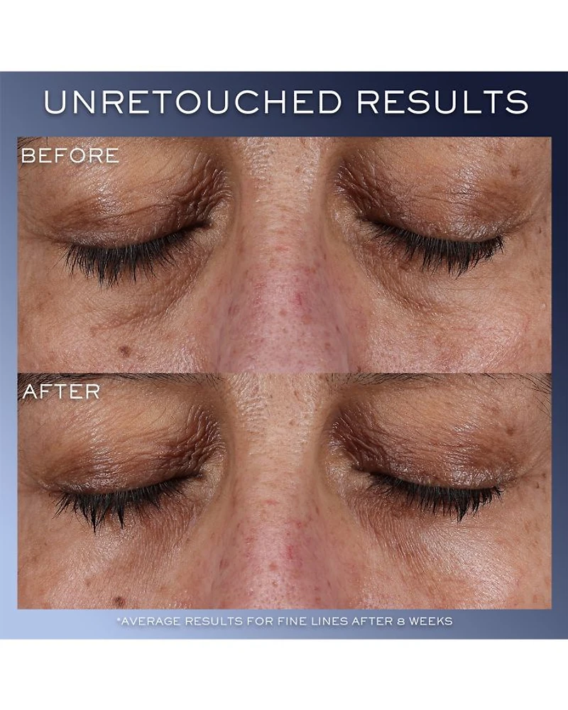 Advanced Génifique Yeux Eye Cream
