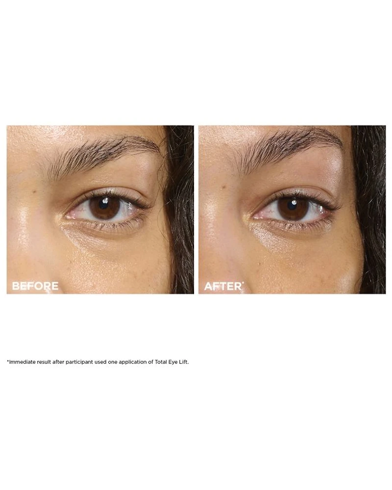 Total Eye Lift Cream