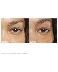 Total Eye Lift Cream