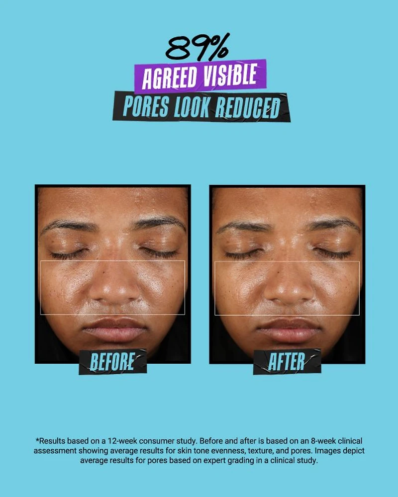 Super Multi Corrective Soft Cream