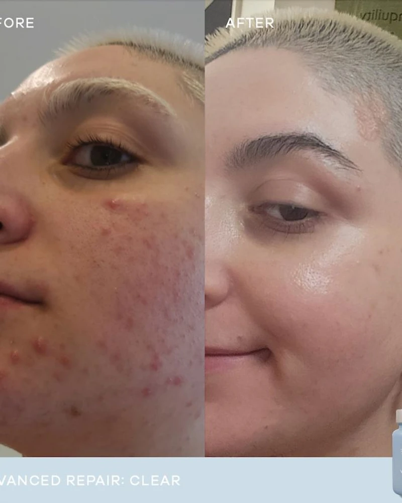 Clear Advanced Repair Dietary Supplement