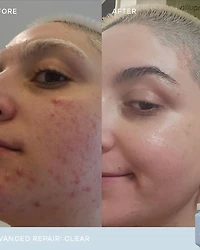 Clear Advanced Repair Dietary Supplement