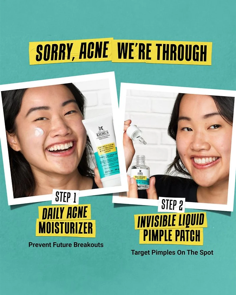 Expertly Clear Acne Treating & Preventing Lotion 2 oz.