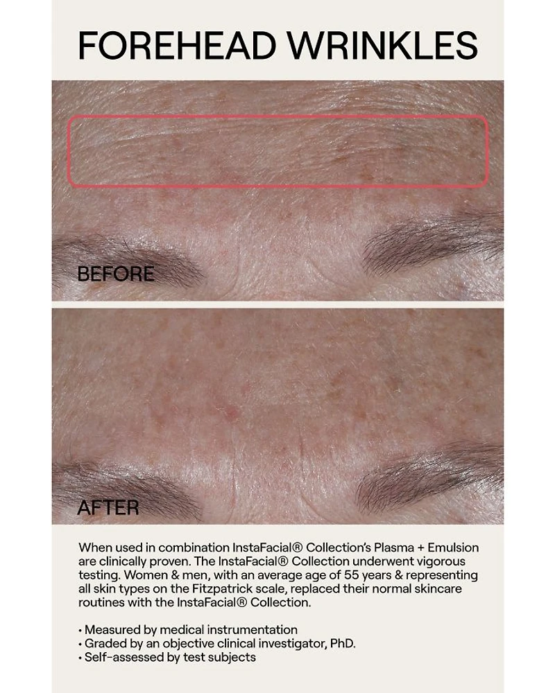 InstaFacial® Plasma Bioactive Growth Factor Serum 1 oz.