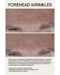 InstaFacial® Plasma Bioactive Growth Factor Serum 1 oz.