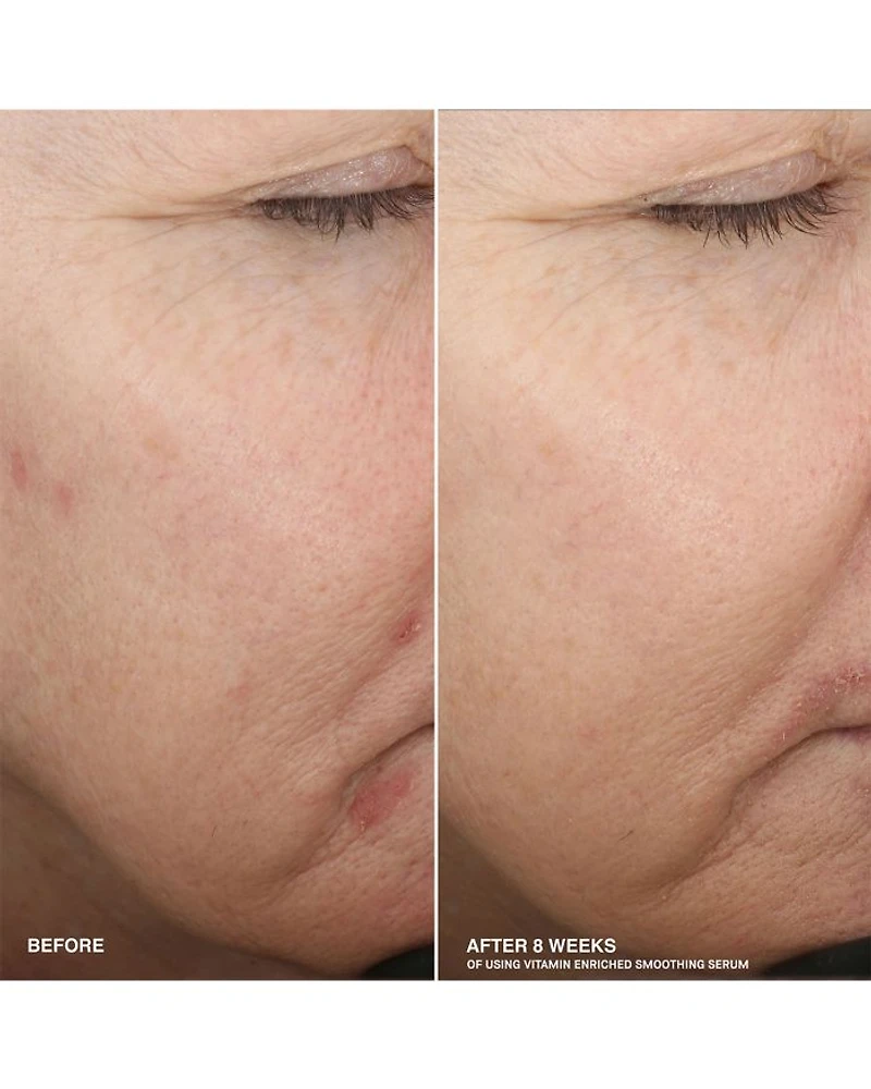 Boost Your Base Vitamin Enriched Moisturizer & Serum Set ($154 value)